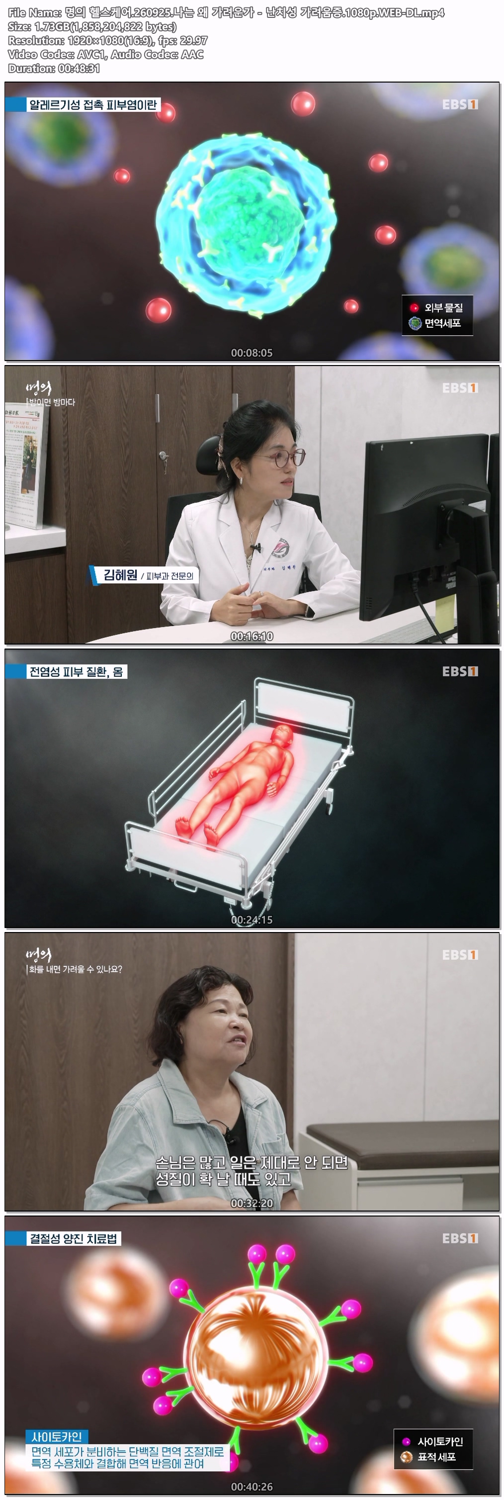 명의 헬스케어.260925.나는 왜 가려운가 - 난치성 가려움증.1080p.WEB-DL