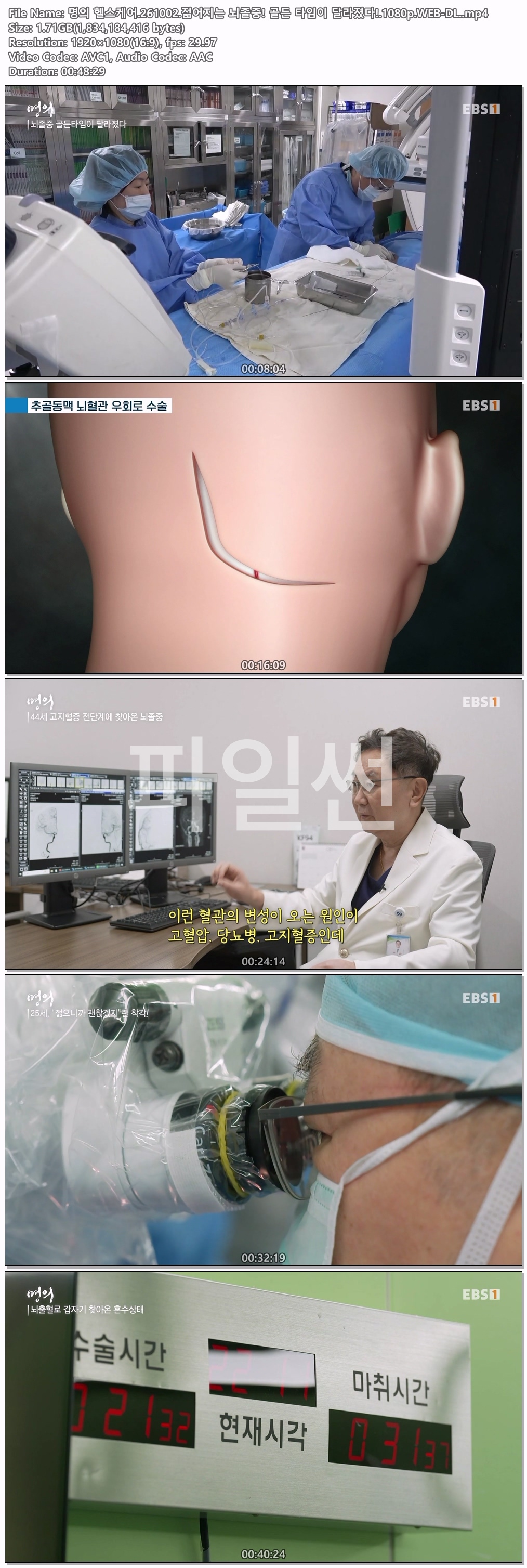 명의 헬스케어.261002.젊어지는 뇌졸중! 골든 타임이 달라졌다!.1080p.WEB-DL.