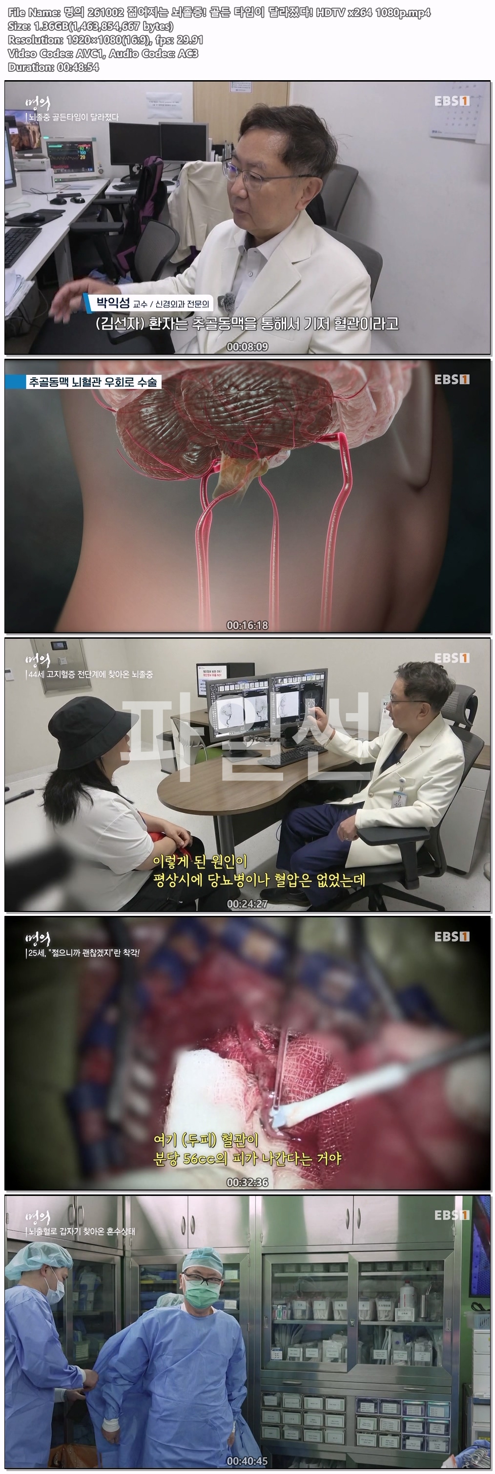 명의 261002 젊어지는 뇌졸증! 골든 타임이 달라졌다! HDTV x264 1080p