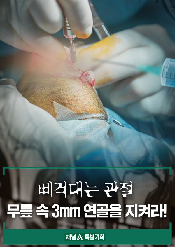 삐걱대는 관절, 무릎 속 3mm 연골을 지켜라!