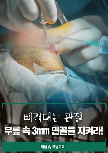 특별기획 삐걱대는 관절, 무릎 속 3mm 연골을 지켜라!